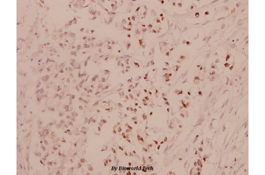 Anti-ATF4 (R239) Antibody from Bioworld Technology (BS1026) - Antibodies.com