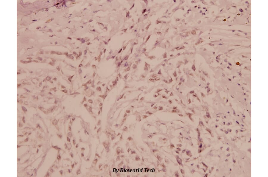 Anti-Bad (F130) Antibody from Bioworld Technology (BS1027) - Antibodies.com