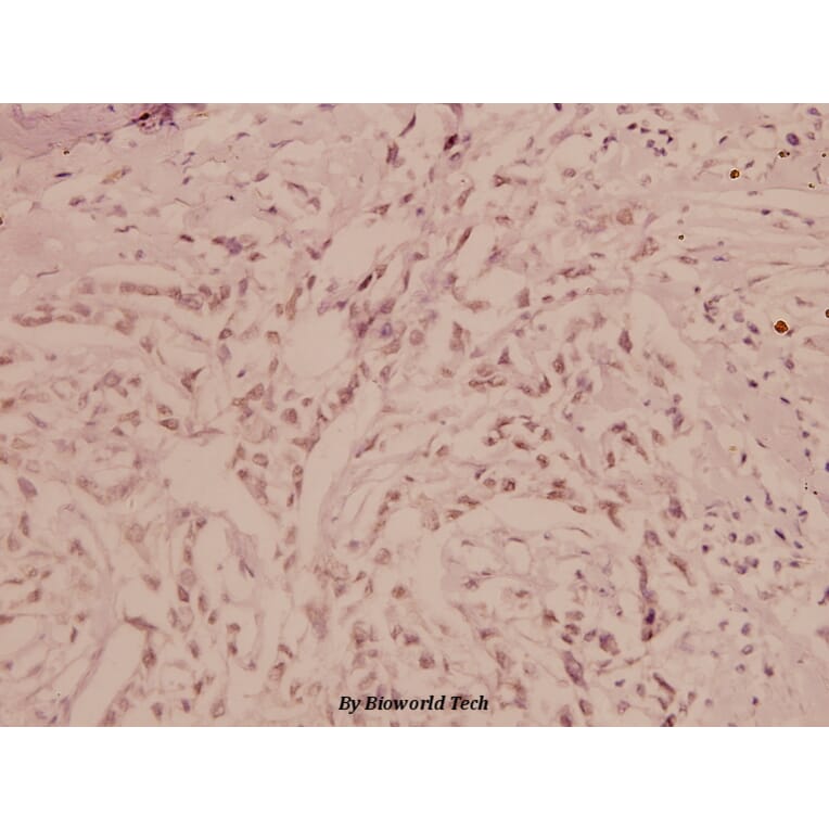 Anti-Bad (F130) Antibody from Bioworld Technology (BS1027) - Antibodies.com