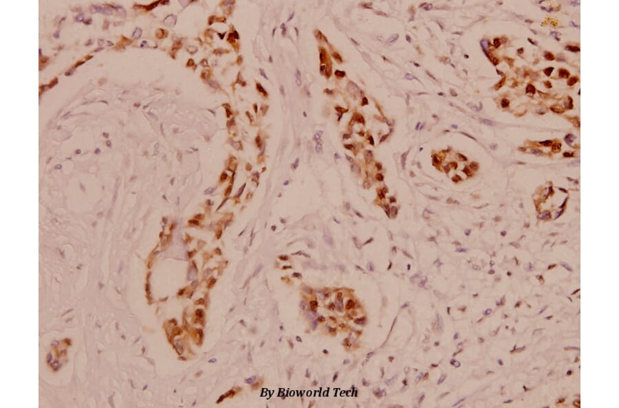 Anti-Bad (R149) Antibody from Bioworld Technology (BS1028) - Antibodies.com