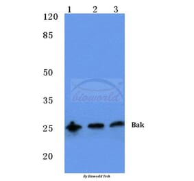 Anti-Bak (A2) Antibody from Bioworld Technology (BS1029) - Antibodies.com