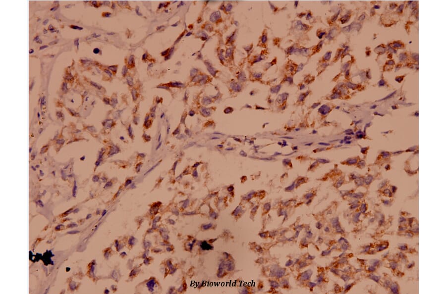 Anti-Bak (A2) Antibody from Bioworld Technology (BS1029) - Antibodies.com