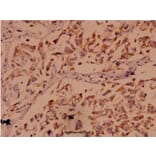 Anti-Bak (A2) Antibody from Bioworld Technology (BS1029) - Antibodies.com