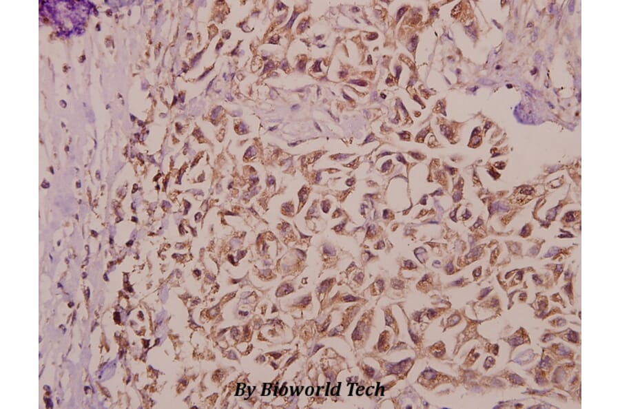 Anti-Bax (S4) Antibody from Bioworld Technology (BS1030) - Antibodies.com