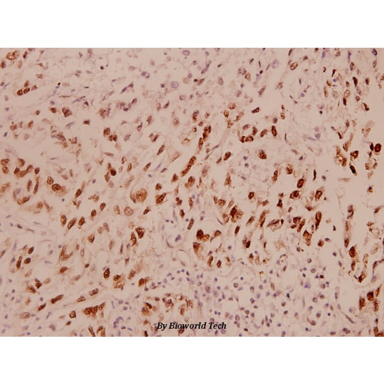 Anti-Bcl-2 (D64) Antibody from Bioworld Technology (BS1031) - Antibodies.com