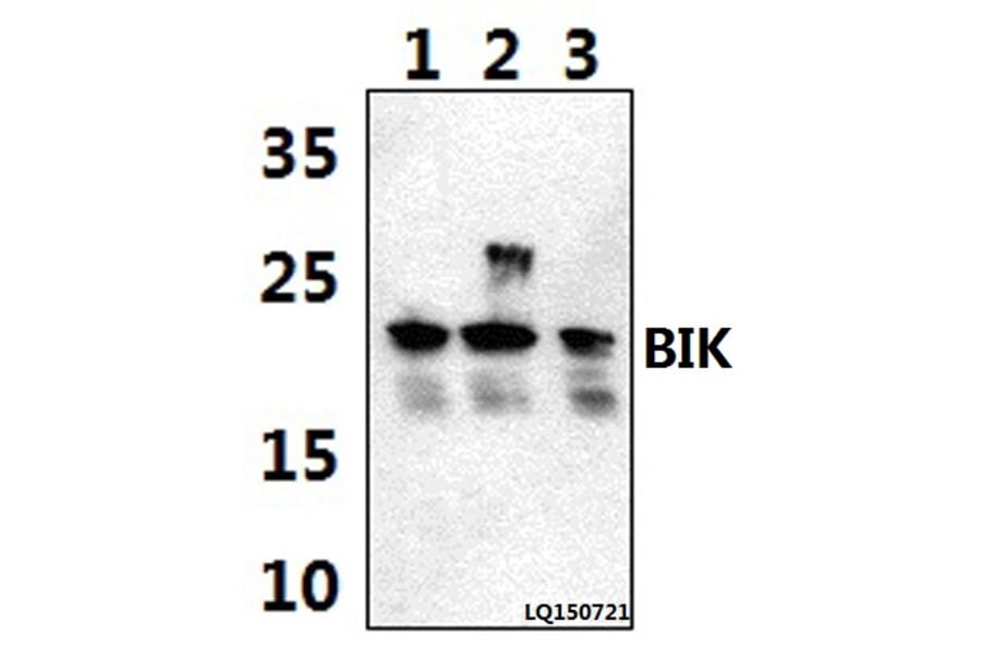 Anti-BIK (M27) Antibody from Bioworld Technology (BS1034) - Antibodies.com