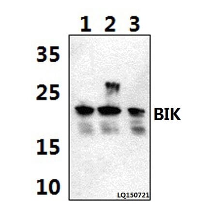 Anti-BIK (M27) Antibody from Bioworld Technology (BS1034) - Antibodies.com