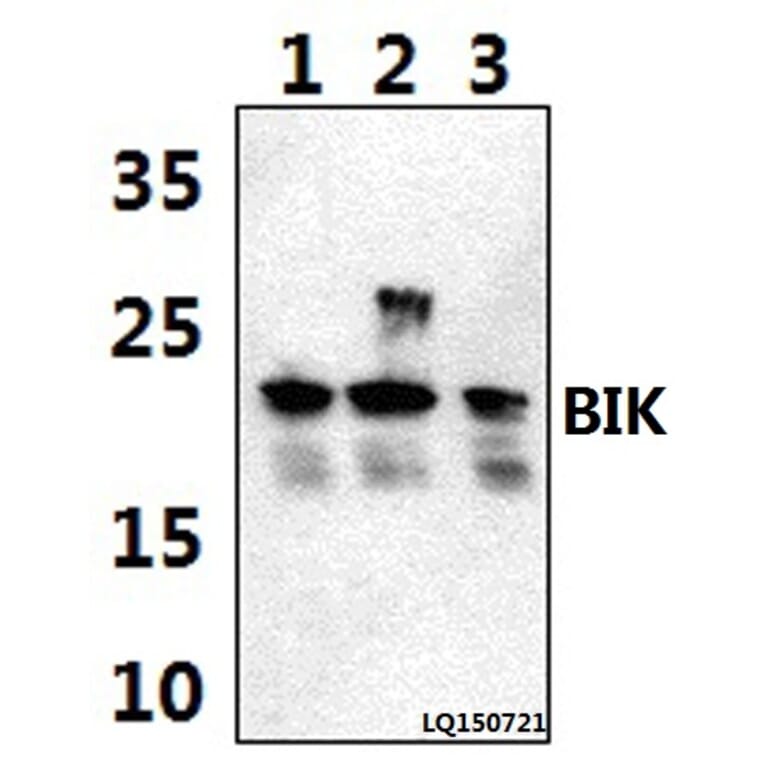 Anti-BIK (M27) Antibody from Bioworld Technology (BS1034) - Antibodies.com