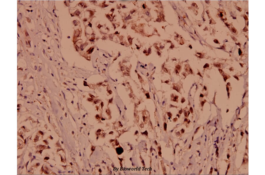 Anti-BIK (M27) Antibody from Bioworld Technology (BS1034) - Antibodies.com
