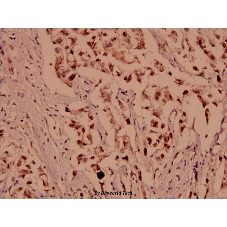 Anti-BIK (M27) Antibody from Bioworld Technology (BS1034) - Antibodies.com