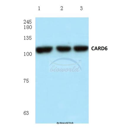 Anti-CARD6 (A2) Antibody from Bioworld Technology (BS1038) - Antibodies.com