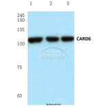 Anti-CARD6 (A2) Antibody from Bioworld Technology (BS1038) - Antibodies.com