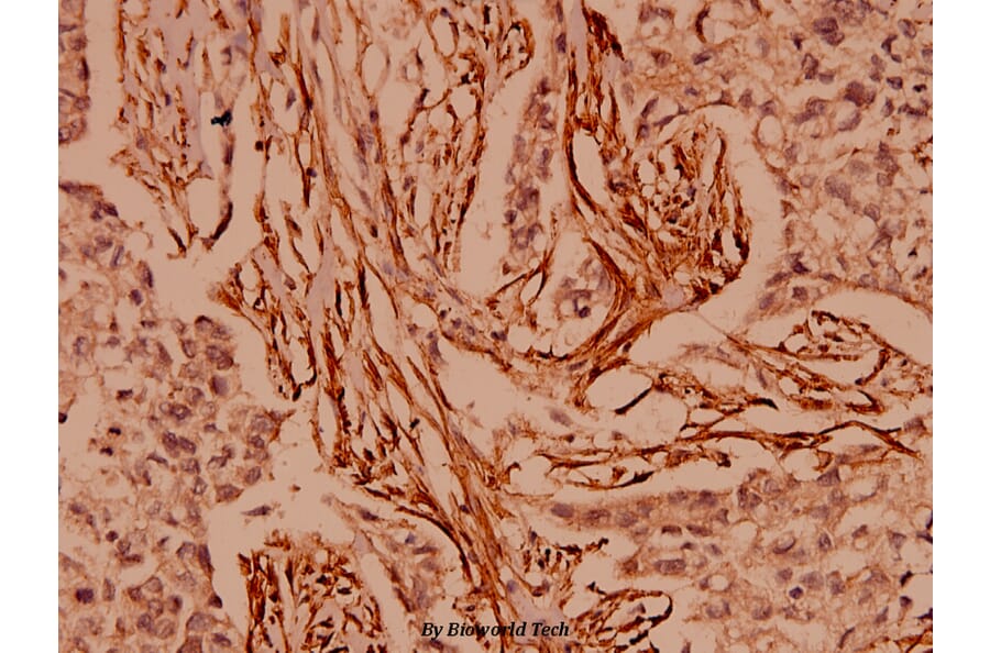 Anti-CARD6 (A2) Antibody from Bioworld Technology (BS1038) - Antibodies.com