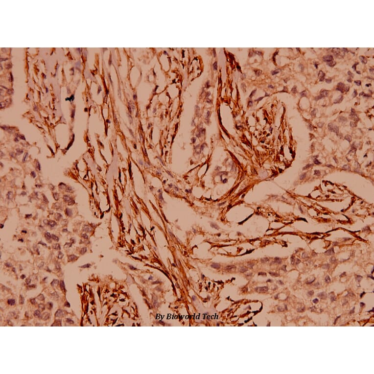 Anti-CARD6 (A2) Antibody from Bioworld Technology (BS1038) - Antibodies.com