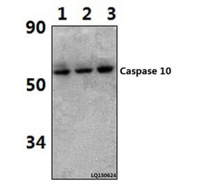 Anti-Caspase 10 (K442) Antibody from Bioworld Technology (BS1039) - Antibodies.com