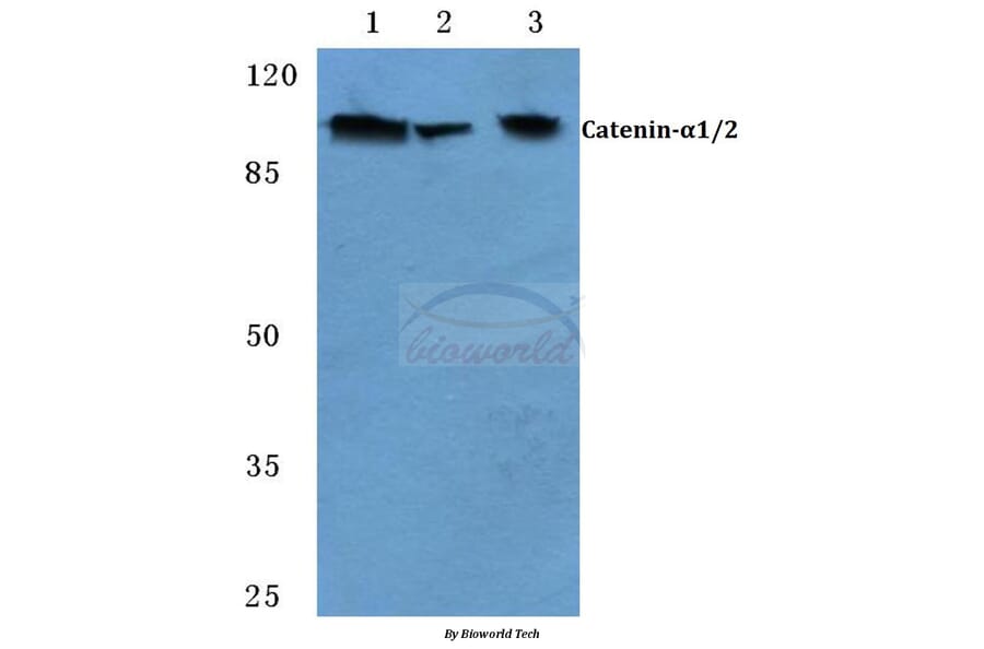 Anti-Catenin-α1/2 (P940) Antibody from Bioworld Technology (BS1040) - Antibodies.com