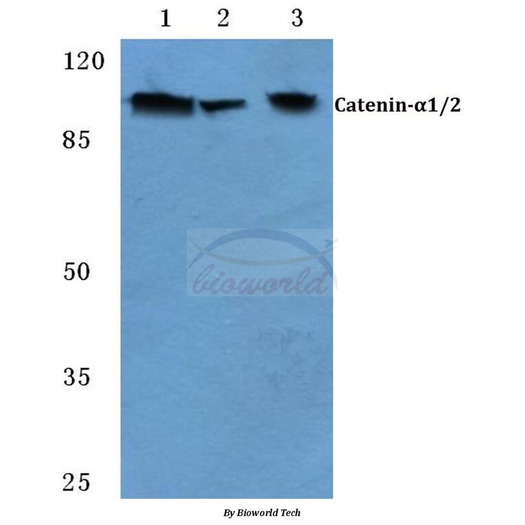 Anti-Catenin-α1/2 (P940) Antibody from Bioworld Technology (BS1040) - Antibodies.com