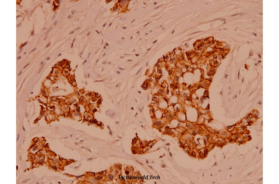 Anti-Catenin-α1/2 (P940) Antibody from Bioworld Technology (BS1040) - Antibodies.com