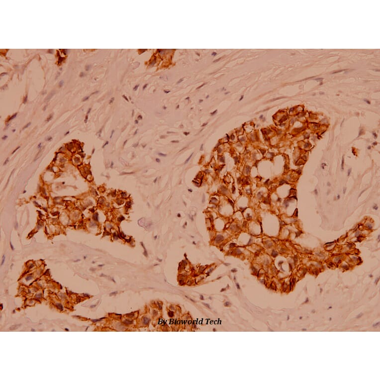 Anti-Catenin-α1/2 (P940) Antibody from Bioworld Technology (BS1040) - Antibodies.com