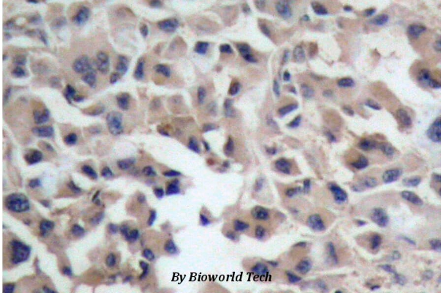 Anti-Catenin-β (I35) Antibody from Bioworld Technology (BS1041) - Antibodies.com
