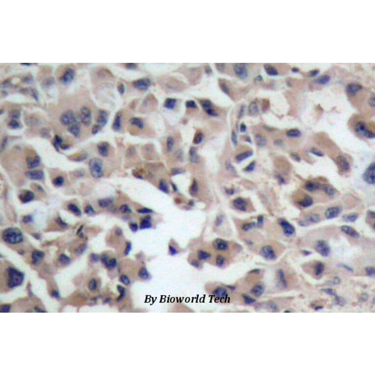 Anti-Catenin-β (I35) Antibody from Bioworld Technology (BS1041) - Antibodies.com