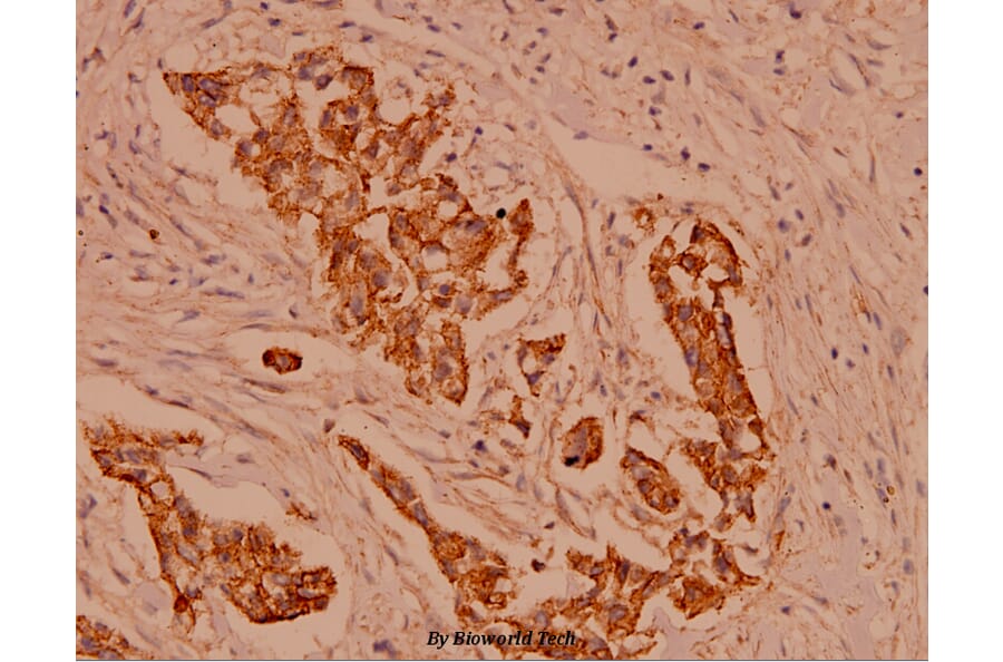 Anti-Catenin-γ (731) Antibody from Bioworld Technology (BS1042) - Antibodies.com
