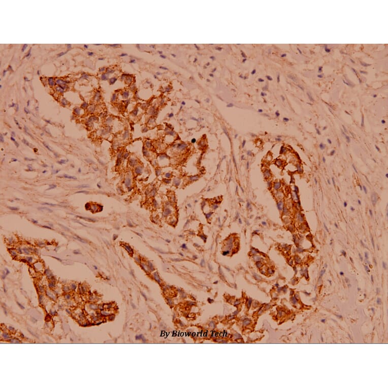 Anti-Catenin-γ (731) Antibody from Bioworld Technology (BS1042) - Antibodies.com