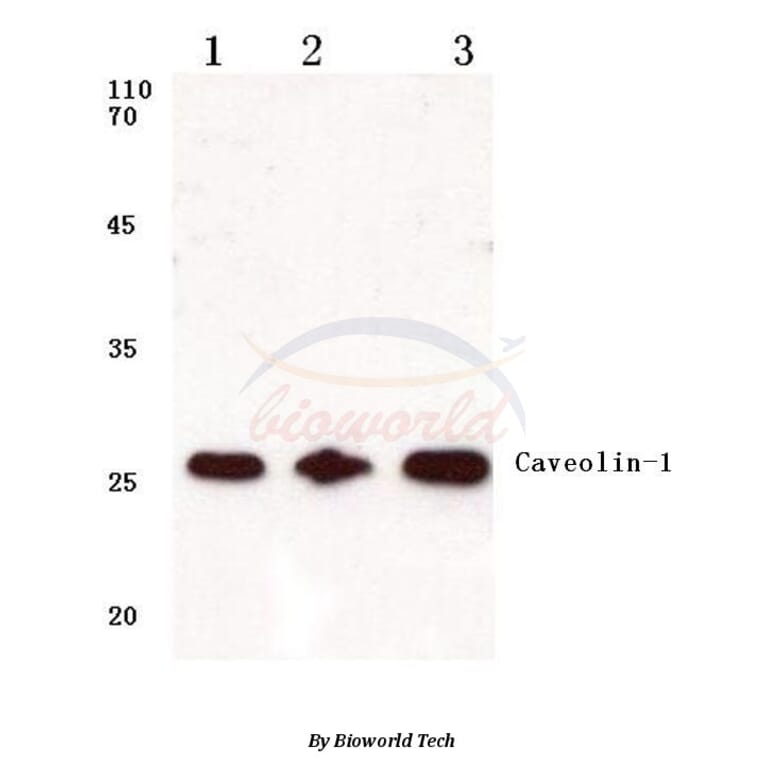 Anti-Caveolin-1 (V163) Antibody from Bioworld Technology (BS1043) - Antibodies.com
