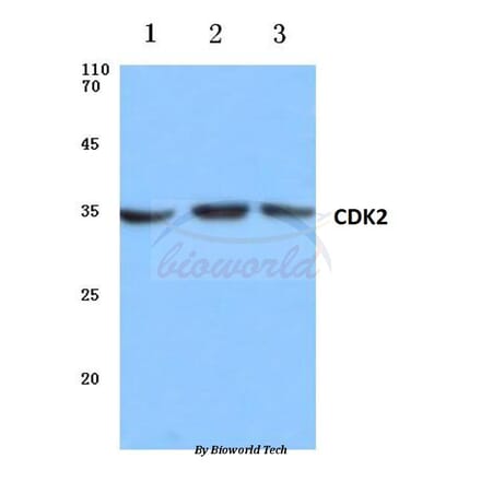 Anti-Cdk2 (V154) Antibody from Bioworld Technology (BS1050) - Antibodies.com