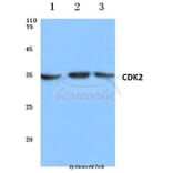 Anti-Cdk2 (V154) Antibody from Bioworld Technology (BS1050) - Antibodies.com