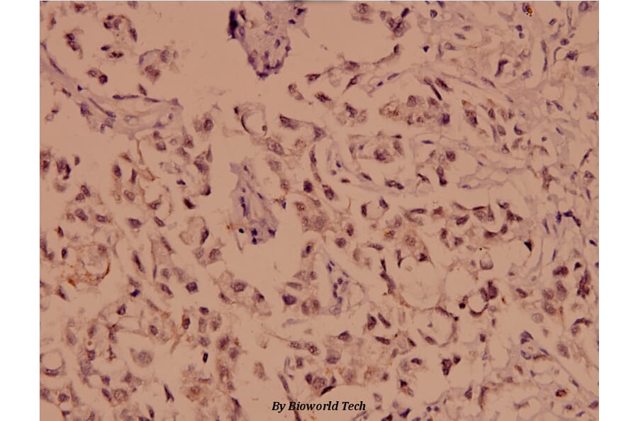 Anti-Chk1 (N311) Antibody from Bioworld Technology (BS1052) - Antibodies.com