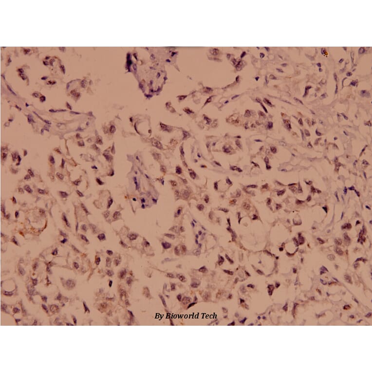 Anti-Chk1 (N311) Antibody from Bioworld Technology (BS1052) - Antibodies.com