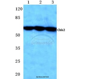 Anti-Chk2 (S62) Antibody from Bioworld Technology (BS1055) - Antibodies.com