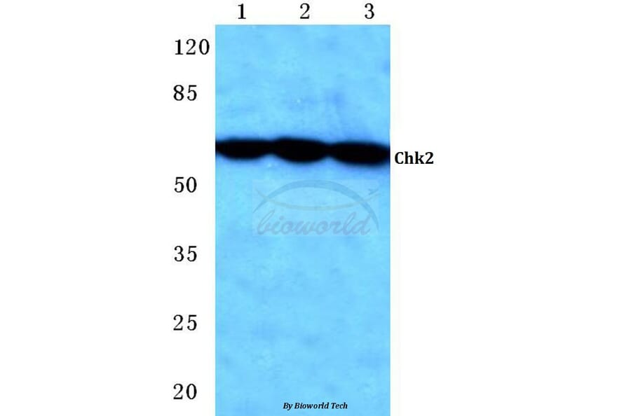 Anti-Chk2 (S62) Antibody from Bioworld Technology (BS1055) - Antibodies.com