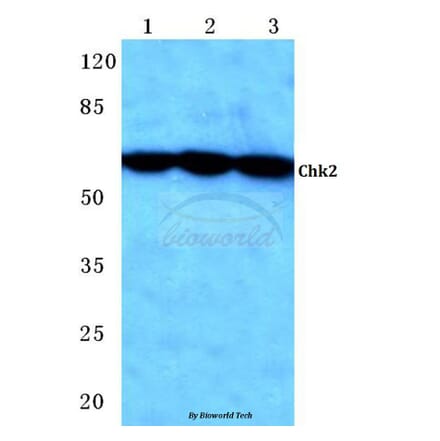 Anti-Chk2 (S62) Antibody from Bioworld Technology (BS1055) - Antibodies.com