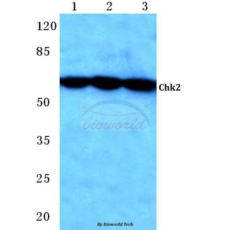 Anti-Chk2 (S62) Antibody from Bioworld Technology (BS1055) - Antibodies.com