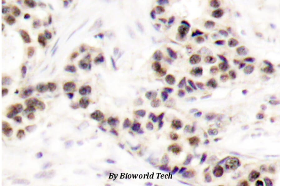 Anti-Chk2 (S62) Antibody from Bioworld Technology (BS1055) - Antibodies.com