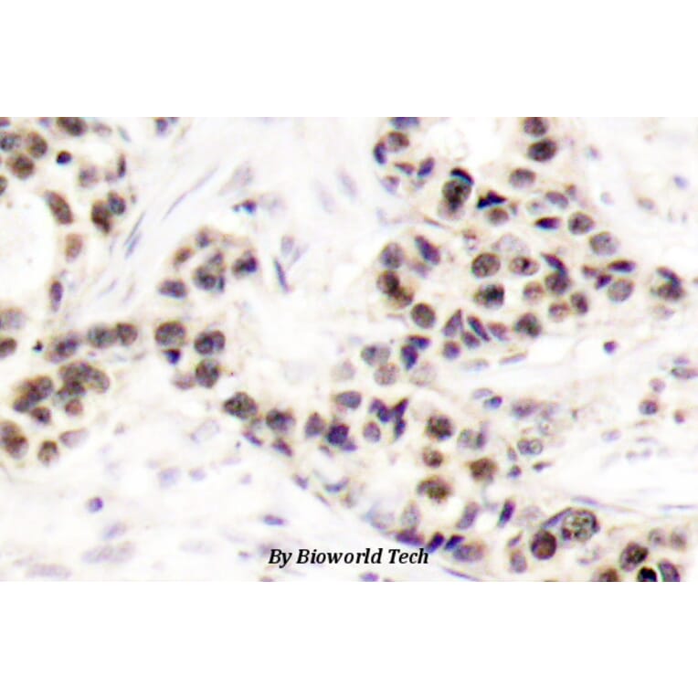 Anti-Chk2 (S62) Antibody from Bioworld Technology (BS1055) - Antibodies.com