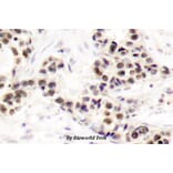 Anti-Chk2 (S62) Antibody from Bioworld Technology (BS1055) - Antibodies.com