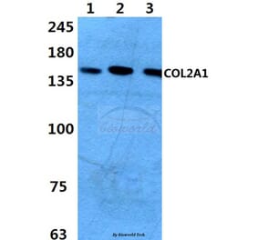 Anti-COL2A1 (P133) Antibody from Bioworld Technology (BS1071) - Antibodies.com