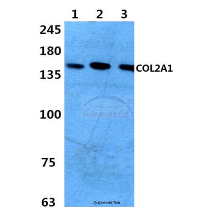 Anti-COL2A1 (P133) Antibody from Bioworld Technology (BS1071) - Antibodies.com