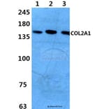 Anti-COL2A1 (P133) Antibody from Bioworld Technology (BS1071) - Antibodies.com