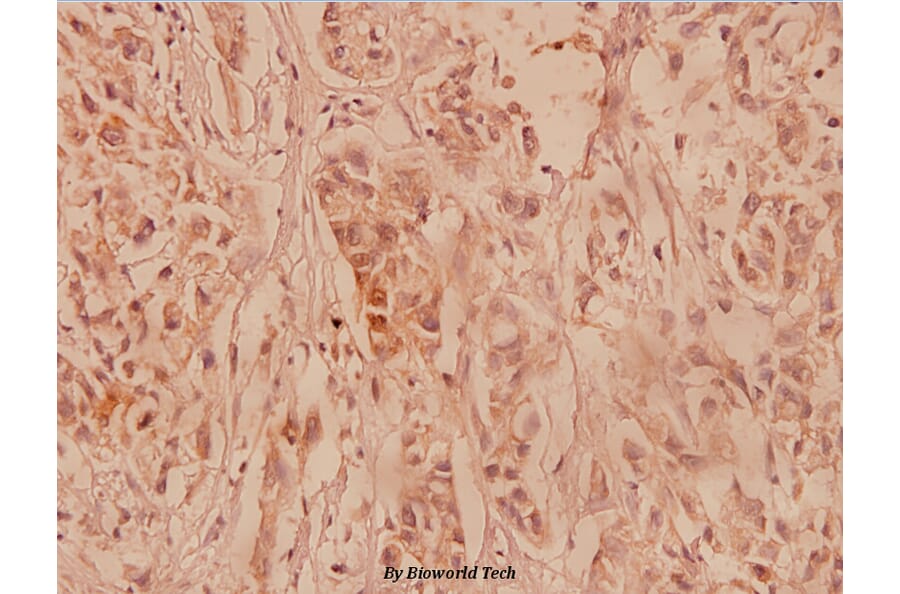 Anti-COL2A1 (P133) Antibody from Bioworld Technology (BS1071) - Antibodies.com