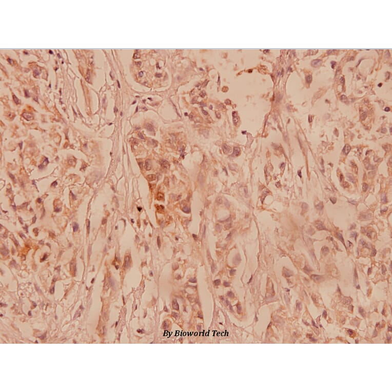 Anti-COL2A1 (P133) Antibody from Bioworld Technology (BS1071) - Antibodies.com