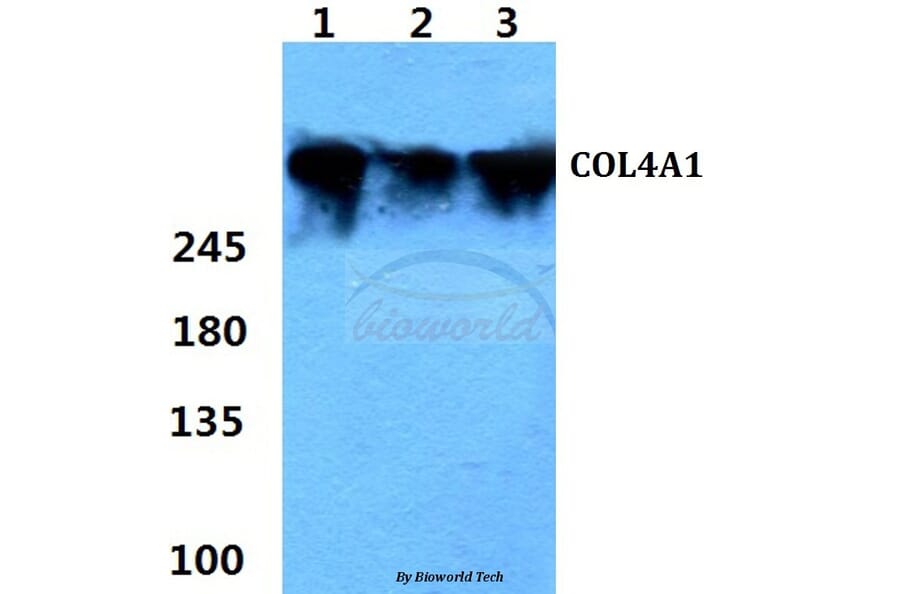 Anti-COL4A1 (G46) Antibody from Bioworld Technology (BS1072) - Antibodies.com