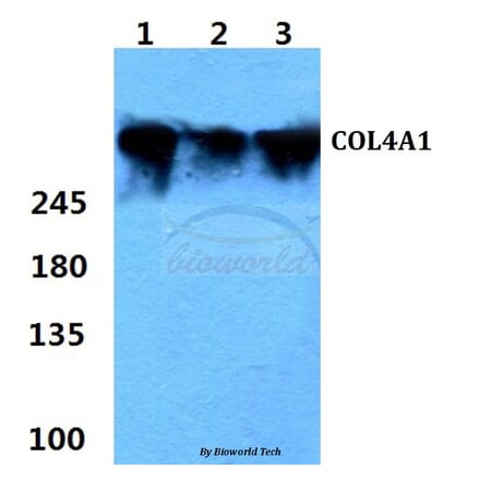 Anti-COL4A1 (G46) Antibody from Bioworld Technology (BS1072) - Antibodies.com