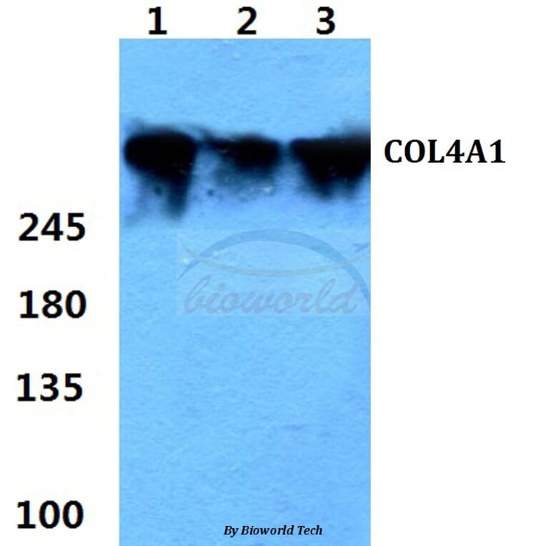 Anti-COL4A1 (G46) Antibody from Bioworld Technology (BS1072) - Antibodies.com