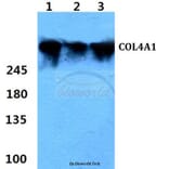 Anti-COL4A1 (G46) Antibody from Bioworld Technology (BS1072) - Antibodies.com