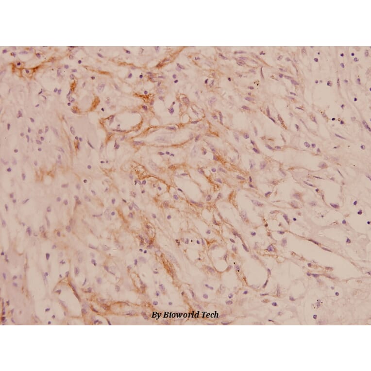 Anti-COL4A1 (G46) Antibody from Bioworld Technology (BS1072) - Antibodies.com