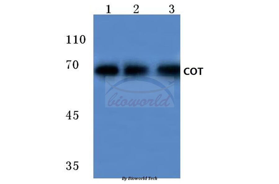 Anti-Cot (P284) Antibody from Bioworld Technology (BS1074) - Antibodies.com